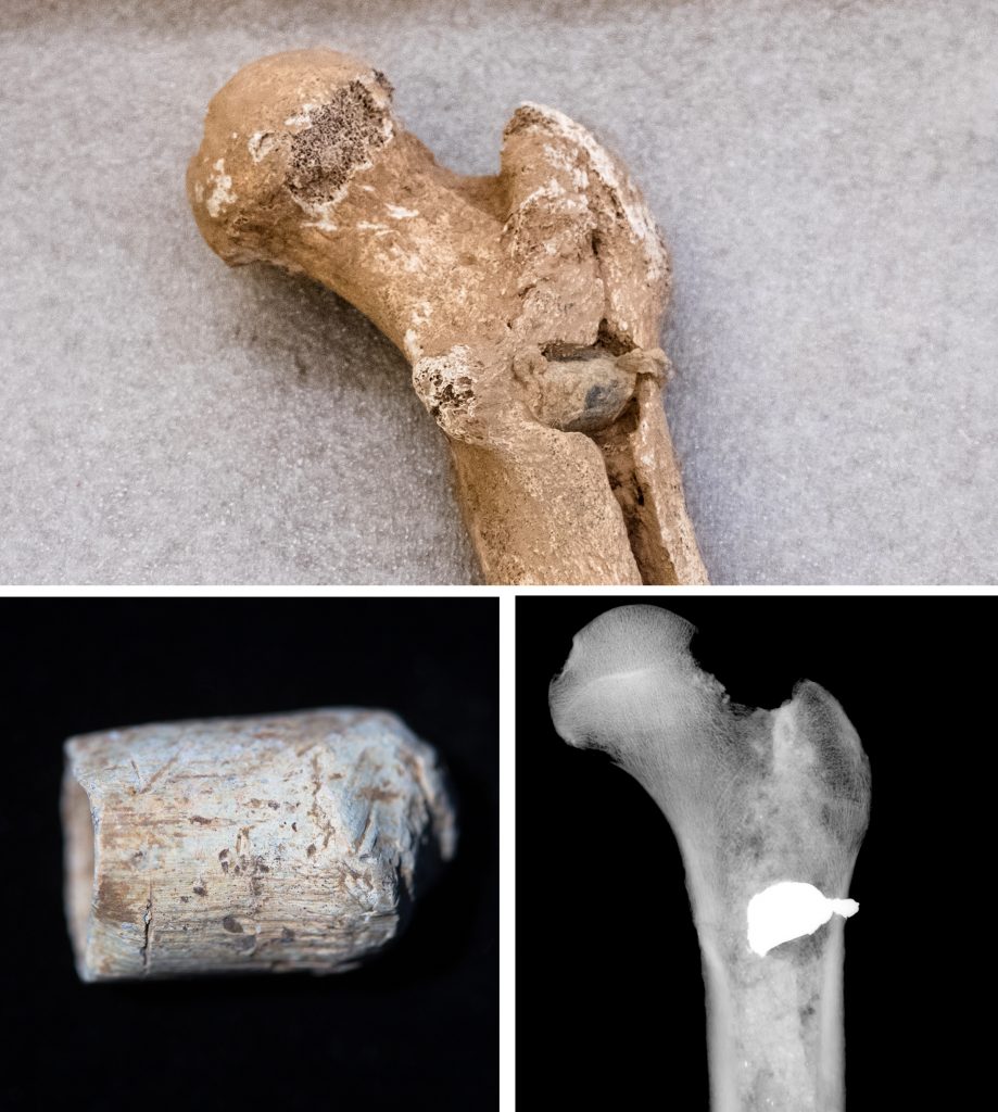 (Top) A bullet lodged in the femur of one of the skeletons. (Lower left) An Enfield bullet from that time period, shows the shape and size of the kind of bullet that killed the soldier. (Lower right) An X-ray shows the position of the embedded bullet in the femur.