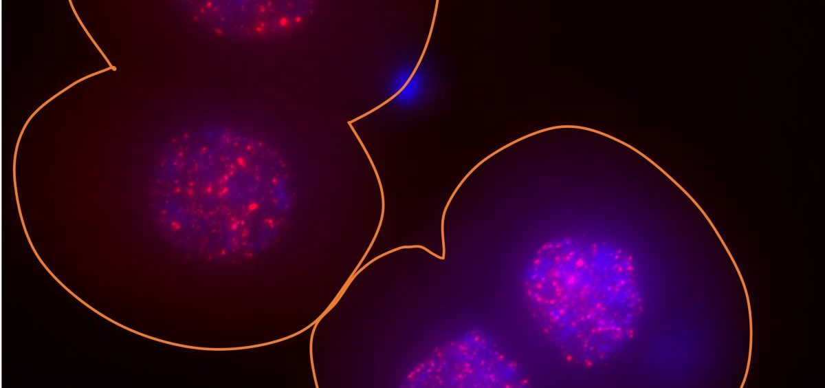 In these two two-cell mouse embryos, the surface of the embryos is outlined in orange, the DNA in the nucleus is indicated in blue and the activity of the LINE-1 gene is indicated via bright red spots.