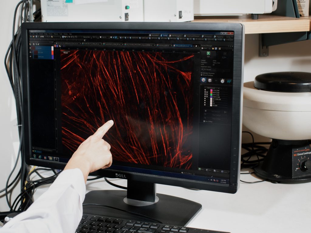 Vink reviews images of smooth muscle cells that her team isolated from cervical biopsies taken from pregnant women at different stages of pregnancy. The stiffness of the cervix changes by "three orders of magnitude" across nine months, Myer has found.