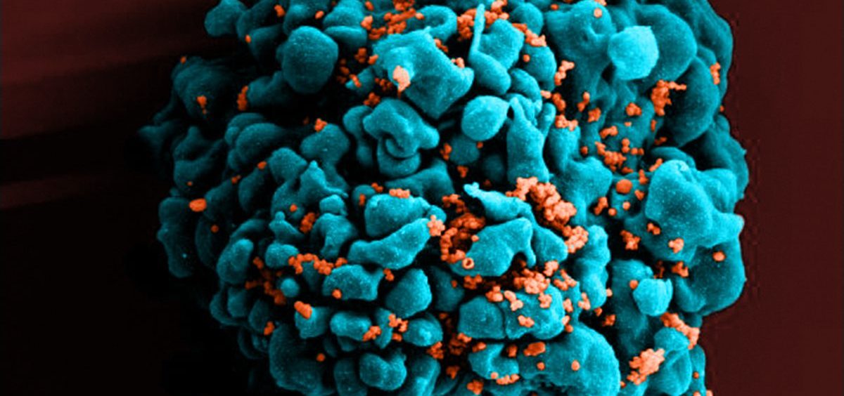 A color-enhanced scanning electron micrograph shows HIV particles (orange) infecting a T cell, one of the white blood cells that play a central role in the immune system.