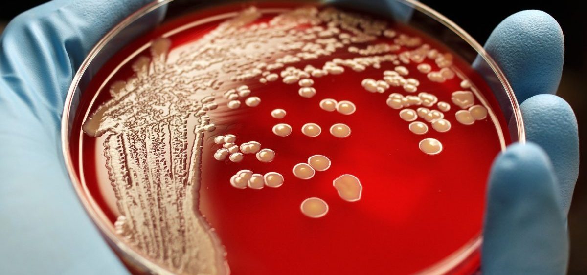 Scientists are exploring new drugs that can fight antibiotic-resistant bacteria such as MRSA.
