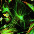 Astrocyte cells like these from the brain of a mouse may differ subtly from those in a human brain.