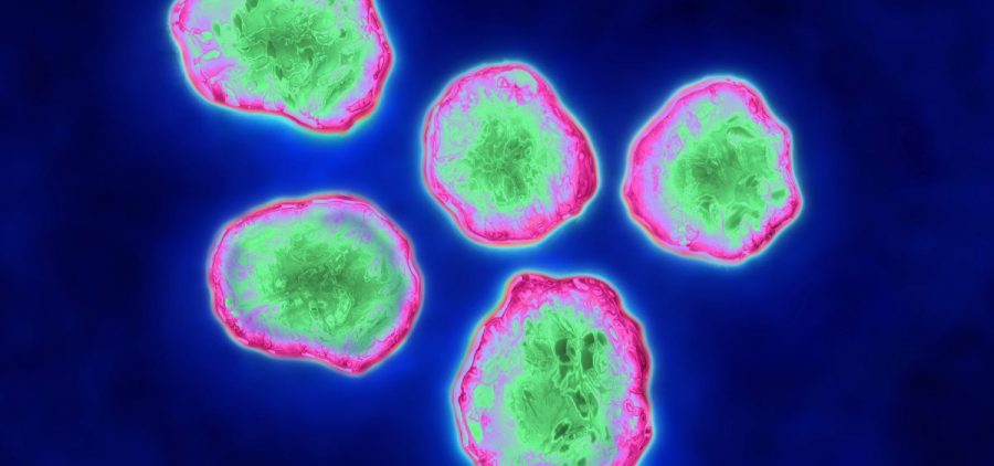 New research illuminates how the measles virus may suppress the immune system after an infection.