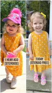 Kelly Brennan's daughter during and after treatment