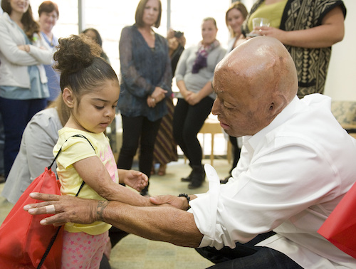 Iraq war veteran burn survivor working with kids with similar injuries