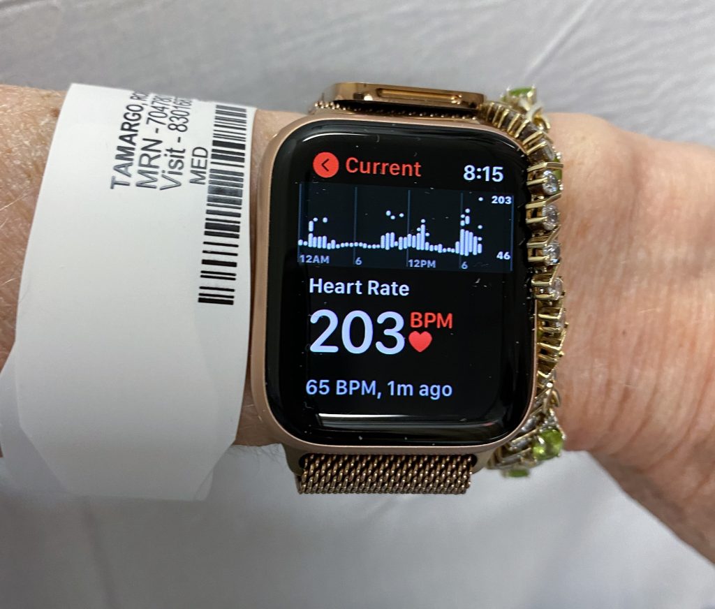 An apple watch on Robi's wrist shows a heart rate of 203 beat per minute