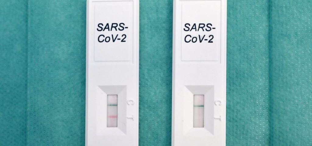 This picture taken on November 6, 2020 in Rome shows positive (L) and negative (R) reagents of rapid test swab for the Covid-19 at Villa Mafalfa clinic.