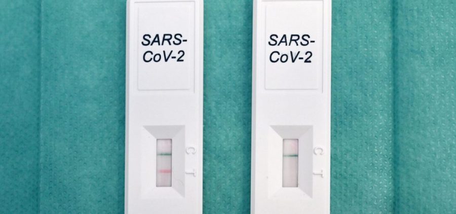 This picture taken on November 6, 2020 in Rome shows positive (L) and negative (R) reagents of rapid test swab for the Covid-19 at Villa Mafalfa clinic.