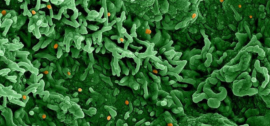 An image from an electron microscope of the monkeypox virus (orange) on infected cells (green).
