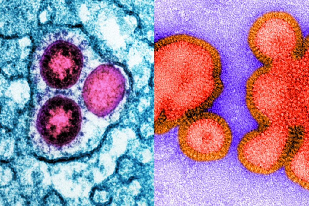 Left: Image of SARS-CoV-2 omicron virus particles (pink) replicating within an infected cell (teal). Right: Image of an inactive H3N2 influenza virus.