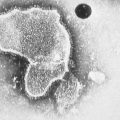 This 1981 photo provided by the Centers for Disease Control and Prevention (CDC) shows an electron micrograph of Respiratory Syncytial Virus.