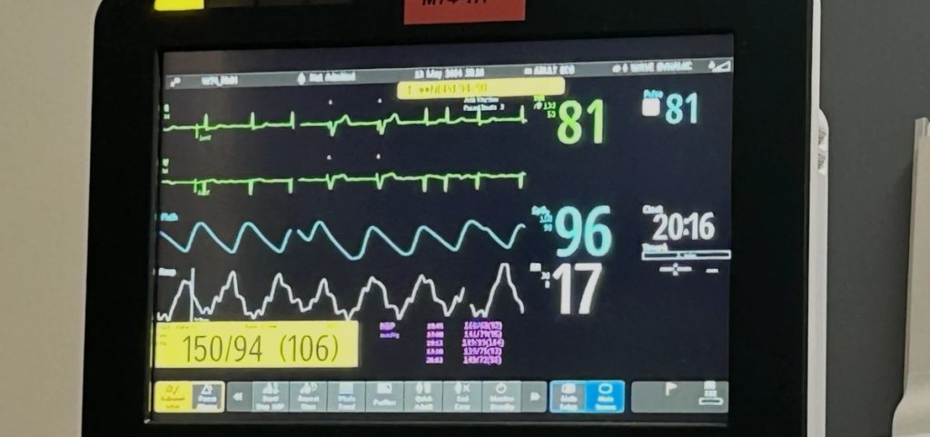 A patient monitor in a hospital room